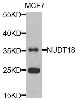 NUDT18 Antibody - Western blot analysis of extracts of MCF7 cells.