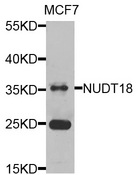 NUDT18 Antibody - Western blot analysis of extracts of MCF7 cells.
