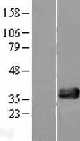 NUDT18 Protein - Western validation with an anti-DDK antibody * L: Control HEK293 lysate R: Over-expression lysate