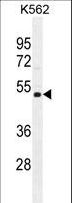 NUDT19 Antibody - NUDT19 Antibody western blot of K562 cell line lysates (35 ug/lane). The NUDT19 antibody detected the NUDT19 protein (arrow).