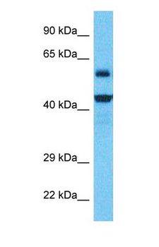 NUDT19 Antibody - Western blot of NUDT19 Antibody with human RPMI-8226 Whole Cell lysate.  This image was taken for the unconjugated form of this product. Other forms have not been tested.