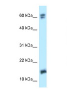NUDT2 Antibody - NUDT2 antibody Western blot of 293T Cell lysate. Antibody concentration 1 ug/ml.  This image was taken for the unconjugated form of this product. Other forms have not been tested.