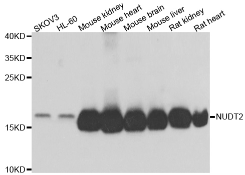 NUDT2 Antibody - Western blot analysis of extracts of various cell lines.