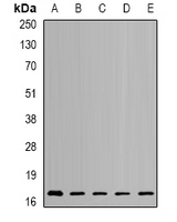 NUDT2 Antibody - Western blot analysis of NUDT2 expression in SKOV3 (A); HL60 (B); mouse kidney (C); mouse brain (D); rat heart (E) whole cell lysates.