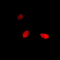 NUDT2 Antibody - Immunofluorescent analysis of NUDT2 staining in HeLa cells. Formalin-fixed cells were permeabilized with 0.1% Triton X-100 in TBS for 5-10 minutes and blocked with 3% BSA-PBS for 30 minutes at room temperature. Cells were probed with the primary antibody in 3% BSA-PBS and incubated overnight at 4 deg C in a humidified chamber. Cells were washed with PBST and incubated with a DyLight 594-conjugated secondary antibody (red) in PBS at room temperature in the dark.
