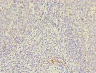 NUDT2 Antibody - Immunohistochemistry of paraffin-embedded human tonsil tissue at dilution 1:100