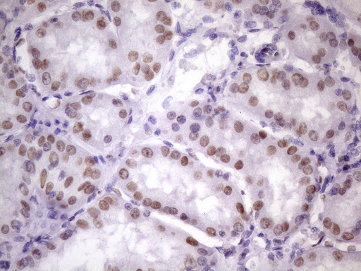 NUDT21 Antibody - IHC of paraffin-embedded Human Kidney tissue using anti-NUDT21 mouse monoclonal antibody. (Heat-induced epitope retrieval by 1 mM EDTA in 10mM Tris, pH8.5, 120°C for 3min)(1:150).