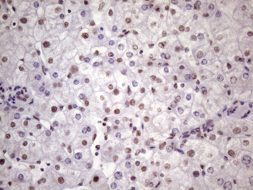 NUDT21 Antibody - IHC of paraffin-embedded Human liver tissue using anti-NUDT21 mouse monoclonal antibody. (Heat-induced epitope retrieval by 1 mM EDTA in 10mM Tris, pH8.5, 120°C for 3min)(1:150).