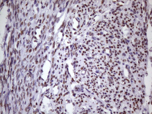 NUDT21 Antibody - IHC of paraffin-embedded Human endometrium tissue using anti-NUDT21 mouse monoclonal antibody. (Heat-induced epitope retrieval by 1 mM EDTA in 10mM Tris, pH8.5, 120°C for 3min)(1:150).