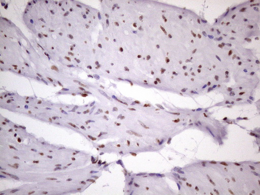 NUDT21 Antibody - IHC of paraffin-embedded Human bladder tissue using anti-NUDT21 mouse monoclonal antibody. (Heat-induced epitope retrieval by 1 mM EDTA in 10mM Tris, pH8.5, 120°C for 3min)(1:150).