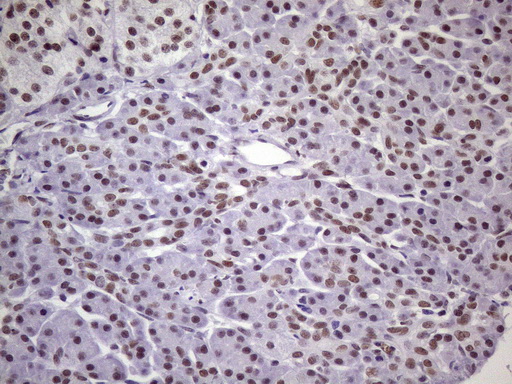 NUDT21 Antibody - Immunohistochemical staining of paraffin-embedded Human pancreas tissue within the normal limits using anti-NUDT21 mouse monoclonal antibody. (Heat-induced epitope retrieval by 1 mM EDTA in 10mM Tris, pH8.5, 120C for 3min. (1:150)
