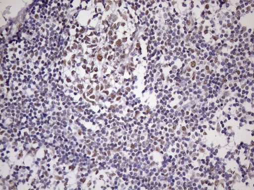 NUDT21 Antibody - Immunohistochemical staining of paraffin-embedded Human tonsil within the normal limits using anti-NUDT21 mouse monoclonal antibody. (Heat-induced epitope retrieval by 1 mM EDTA in 10mM Tris, pH8.5, 120C for 3min. (1:150)