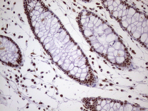 NUDT21 Antibody - Immunohistochemical staining of paraffin-embedded Human colon tissue within the normal limits using anti-NUDT21 mouse monoclonal antibody. (Heat-induced epitope retrieval by 1 mM EDTA in 10mM Tris, pH8.5, 120C for 3min. (1:150)
