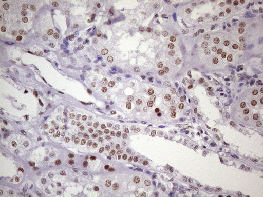 NUDT21 Antibody - Immunohistochemical staining of paraffin-embedded Human Kidney tissue within the normal limits using anti-NUDT21 mouse monoclonal antibody. (Heat-induced epitope retrieval by 1 mM EDTA in 10mM Tris, pH8.5, 120C for 3min. (1:150)