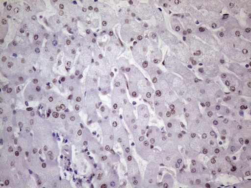 NUDT21 Antibody - Immunohistochemical staining of paraffin-embedded Human liver tissue within the normal limits using anti-NUDT21 mouse monoclonal antibody. (Heat-induced epitope retrieval by 1 mM EDTA in 10mM Tris, pH8.5, 120C for 3min. (1:150)