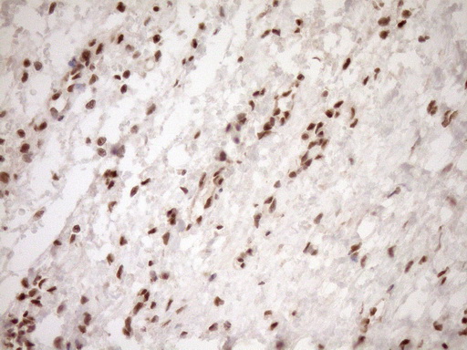 NUDT21 Antibody - Immunohistochemical staining of paraffin-embedded Human Ovary tissue within the normal limits using anti-NUDT21 mouse monoclonal antibody. (Heat-induced epitope retrieval by 1mM EDTA in 10mM Tris buffer. (pH8.5) at 120°C for 3 min. (1:150)