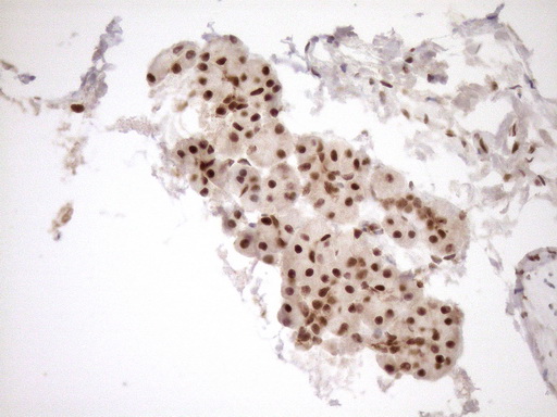 NUDT21 Antibody - Immunohistochemical staining of paraffin-embedded Human pancreas tissue within the normal limits using anti-NUDT21 mouse monoclonal antibody. (Heat-induced epitope retrieval by 1mM EDTA in 10mM Tris buffer. (pH8.5) at 120°C for 3 min. (1:150)