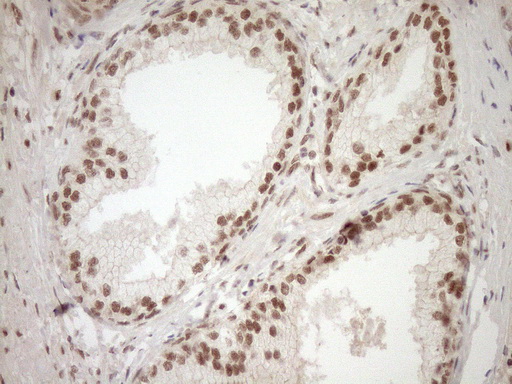 NUDT21 Antibody - Immunohistochemical staining of paraffin-embedded Human prostate tissue within the normal limits using anti-NUDT21 mouse monoclonal antibody. (Heat-induced epitope retrieval by 1mM EDTA in 10mM Tris buffer. (pH8.5) at 120°C for 3 min. (1:150)