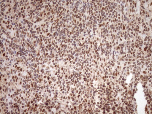 NUDT21 Antibody - Immunohistochemical staining of paraffin-embedded Human lymph node tissue within the normal limits using anti-NUDT21 mouse monoclonal antibody. (Heat-induced epitope retrieval by 1mM EDTA in 10mM Tris buffer. (pH8.5) at 120°C for 3 min. (1:150)