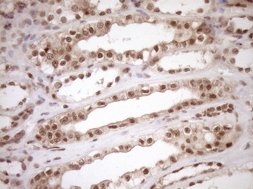 NUDT21 Antibody - Immunohistochemical staining of paraffin-embedded Human Kidney tissue within the normal limits using anti-NUDT21 mouse monoclonal antibody. (Heat-induced epitope retrieval by 1mM EDTA in 10mM Tris buffer. (pH8.5) at 120°C for 3 min. (1:150)