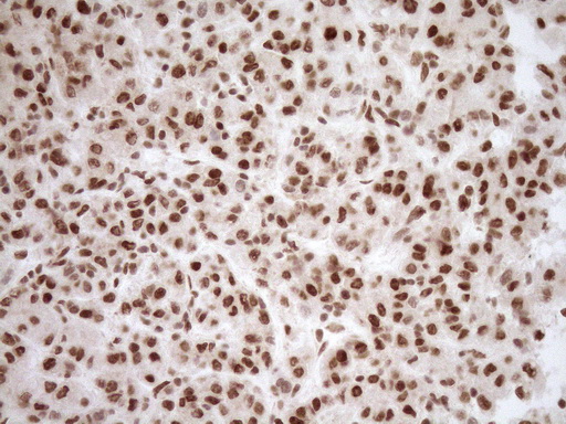 NUDT21 Antibody - Immunohistochemical staining of paraffin-embedded Human liver tissue within the normal limits using anti-NUDT21 mouse monoclonal antibody. (Heat-induced epitope retrieval by 1mM EDTA in 10mM Tris buffer. (pH8.5) at 120°C for 3 min. (1:150)