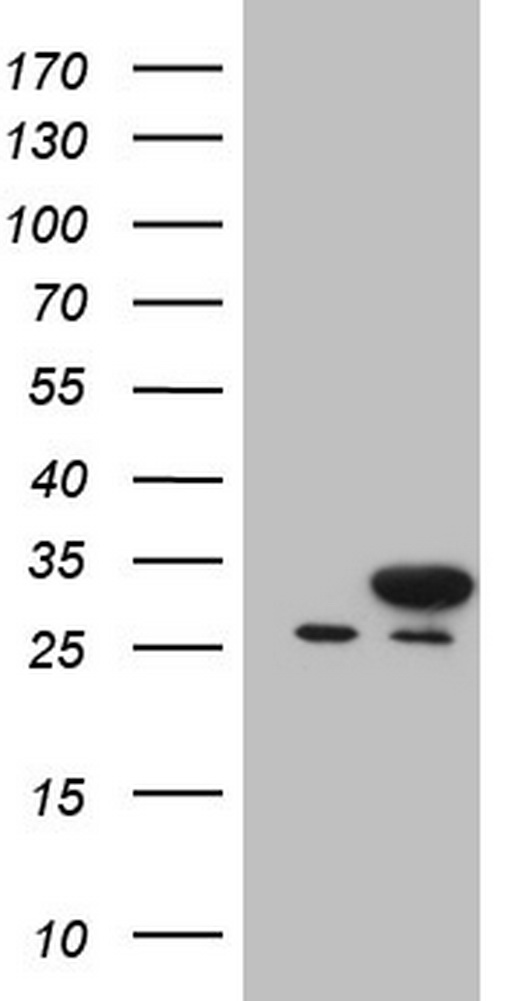 NUDT21 Antibody - HEK293T cells were transfected with the pCMV6-ENTRY control. (Left lane) or pCMV6-ENTRY NUDT21. (Right lane) cDNA for 48 hrs and lysed. Equivalent amounts of cell lysates. (5 ug per lane) were separated by SDS-PAGE and immunoblotted with anti-NUDT21.
