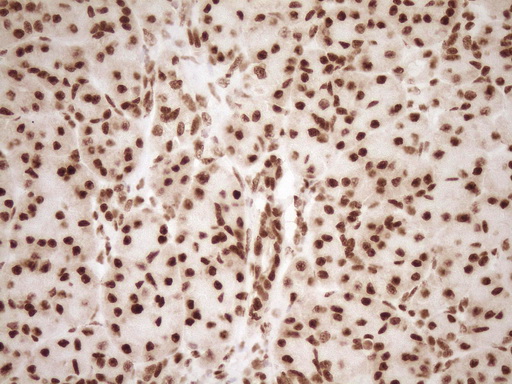 NUDT21 Antibody - Immunohistochemical staining of paraffin-embedded Human pancreas tissue within the normal limits using anti-NUDT21 mouse monoclonal antibody. (Heat-induced epitope retrieval by 1 mM EDTA in 10mM Tris, pH8.5, 120C for 3min,