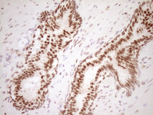NUDT21 Antibody - Immunohistochemical staining of paraffin-embedded Human prostate tissue within the normal limits using anti-NUDT21 mouse monoclonal antibody. (Heat-induced epitope retrieval by 1 mM EDTA in 10mM Tris, pH8.5, 120C for 3min,