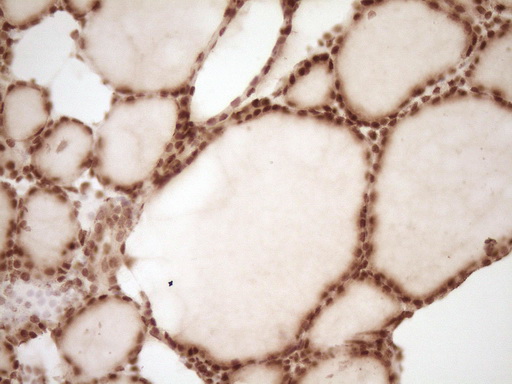 NUDT21 Antibody - IHC of paraffin-embedded Human thyroid tissue using anti-NUDT21 mouse monoclonal antibody. (Heat-induced epitope retrieval by 1 mM EDTA in 10mM Tris, pH8.5, 120°C for 3min).