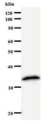 NUDT21 Antibody - Western blot of immunized recombinant protein using NUDT21 antibody.