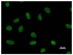 NUDT21 Antibody - Immunofluorescent staining using NUDT21 antibody. Immunostaining analysis in HeLa cells. HeLa cells were fixed with 4% paraformaldehyde and permeabilized with 0.01% Triton-X100 in PBS. The cells were immunostained with anti-NUDT21 antibody.