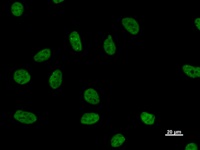 NUDT21 Antibody - Immunostaining analysis in HeLa cells. HeLa cells were fixed with 4% paraformaldehyde and permeabilized with 0.1% Triton X-100 in PBS. The cells were immunostained with anti-NUDT21 mAb.