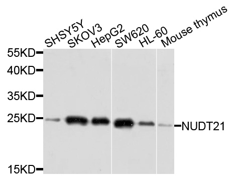 NUDT21 Antibody - Western blot analysis of extracts of various cells.