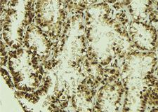 NUDT21 Antibody - 1:100 staining human lung tissue by IHC-P. The sample was formaldehyde fixed and a heat mediated antigen retrieval step in citrate buffer was performed. The sample was then blocked and incubated with the antibody for 1.5 hours at 22°C. An HRP conjugated goat anti-rabbit antibody was used as the secondary.