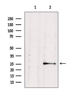 NUDT21 Antibody - Western blot analysis of extracts of HepG2 cells using NUDT21 antibody. Lane 1 was treated with the blocking peptide.