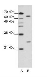 NUDT21 Antibody - A: Marker, B: HepG2 Cell Lysate.  This image was taken for the unconjugated form of this product. Other forms have not been tested.