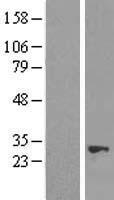 NUDT21 Protein - Western validation with an anti-DDK antibody * L: Control HEK293 lysate R: Over-expression lysate