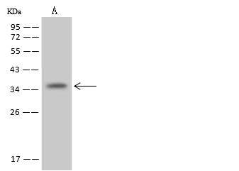 NUDT22 Antibody - Anti-NUDT22 rabbit polyclonal antibody at 1:500 dilution. Lane A: Jurkat Whole Cell Lysate. Lysates/proteins at 30 ug per lane. Secondary: Goat Anti-Rabbit IgG (H+L)/HRP at 1/10000 dilution. Developed using the ECL technique. Performed under reducing conditions. Predicted band size: 33 kDa. Observed band size: 36 kDa.