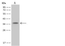 NUDT22 Antibody - Anti-NUDT22 rabbit polyclonal antibody at 1:500 dilution. Lane A: Jurkat Whole Cell Lysate. Lysates/proteins at 30 ug per lane. Secondary: Goat Anti-Rabbit IgG (H+L)/HRP at 1/10000 dilution. Developed using the ECL technique. Performed under reducing conditions. Predicted band size: 33 kDa. Observed band size: 36 kDa.