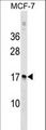 NUDT4 Antibody - NUDT4 Antibody western blot of MCF-7 cell line lysates (35 ug/lane). The NUDT4 antibody detected the NUDT4 protein (arrow).