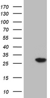 NUDT4 Antibody - HEK293T cells were transfected with the pCMV6-ENTRY control. (Left lane) or pCMV6-ENTRY NUDT4. (Right lane) cDNA for 48 hrs and lysed. Equivalent amounts of cell lysates. (5 ug per lane) were separated by SDS-PAGE and immunoblotted with anti-NUDT4. (1:2000)