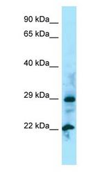 NUDT5 Antibody - NUDT5 antibody Western Blot of 721_B.  This image was taken for the unconjugated form of this product. Other forms have not been tested.