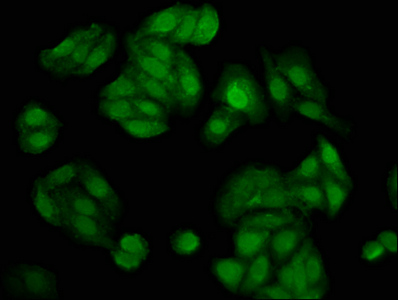 NUDT5 Antibody - Immunofluorescence staining of HepG2 cells at a dilution of 1:200, counter-stained with DAPI. The cells were fixed in 4% formaldehyde, permeabilized using 0.2% Triton X-100 and blocked in 10% normal Goat Serum. The cells were then incubated with the antibody overnight at 4 °C.The secondary antibody was Alexa Fluor 488-congugated AffiniPure Goat Anti-Rabbit IgG (H+L) .