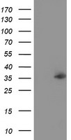 NUDT6 Antibody - HEK293T cells were transfected with the pCMV6-ENTRY control (Left lane) or pCMV6-ENTRY NUDT6 (Right lane) cDNA for 48 hrs and lysed. Equivalent amounts of cell lysates (5 ug per lane) were separated by SDS-PAGE and immunoblotted with anti-NUDT6.