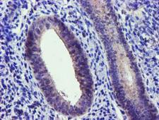 NUDT6 Antibody - IHC of paraffin-embedded Human endometrium tissue using anti-NUDT6 mouse monoclonal antibody.