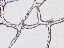 NUDT6 Antibody - IHC of paraffin-embedded Human thyroid tissue using anti-NUDT6 mouse monoclonal antibody.