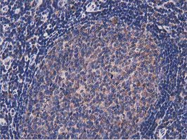 NUDT6 Antibody - IHC of paraffin-embedded Human lymph node tissue using anti-NUDT6 mouse monoclonal antibody.