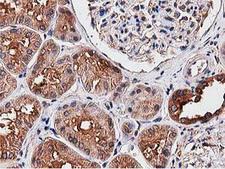 NUDT6 Antibody - IHC of paraffin-embedded Human Kidney tissue using anti-NUDT6 mouse monoclonal antibody.