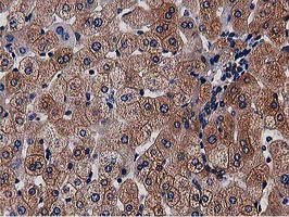 NUDT6 Antibody - IHC of paraffin-embedded Human liver tissue using anti-NUDT6 mouse monoclonal antibody.