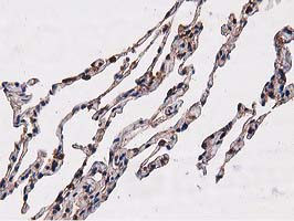 NUDT6 Antibody - IHC of paraffin-embedded Human lung tissue using anti-NUDT6 mouse monoclonal antibody.